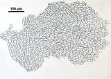 Visione superficiale dell’ipotallo poliflabellato